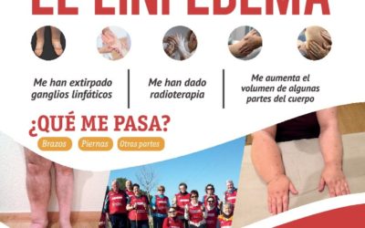 ADPLA Y EL LINFEDEMA