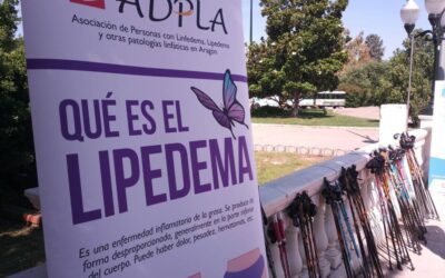 Moviéndonos por el Lipedema