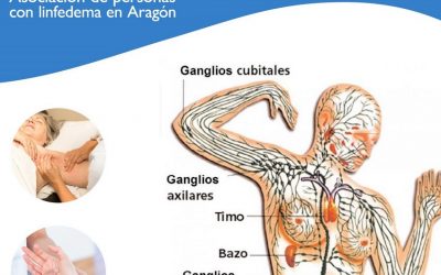 ¿Conoces el Sistema Linfático?